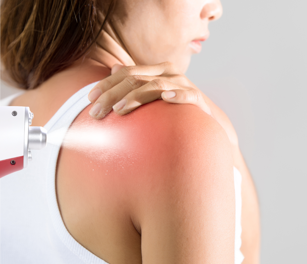 A close-up of a CO₂ cryotherapy device applying localized cooling therapy to support injury repair and pain relief