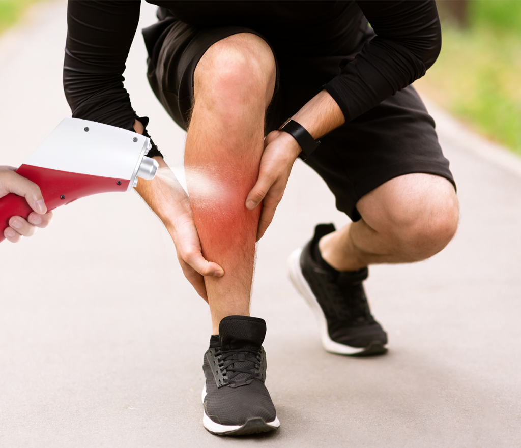 Using CO₂ Cryotherapy to treat a man's sprain injury